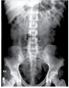 Série Sem Contraste UIV